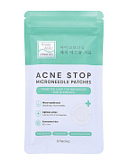 Патчи от прыщей и акне с микроиглами, Beauty Style, 8 шт.