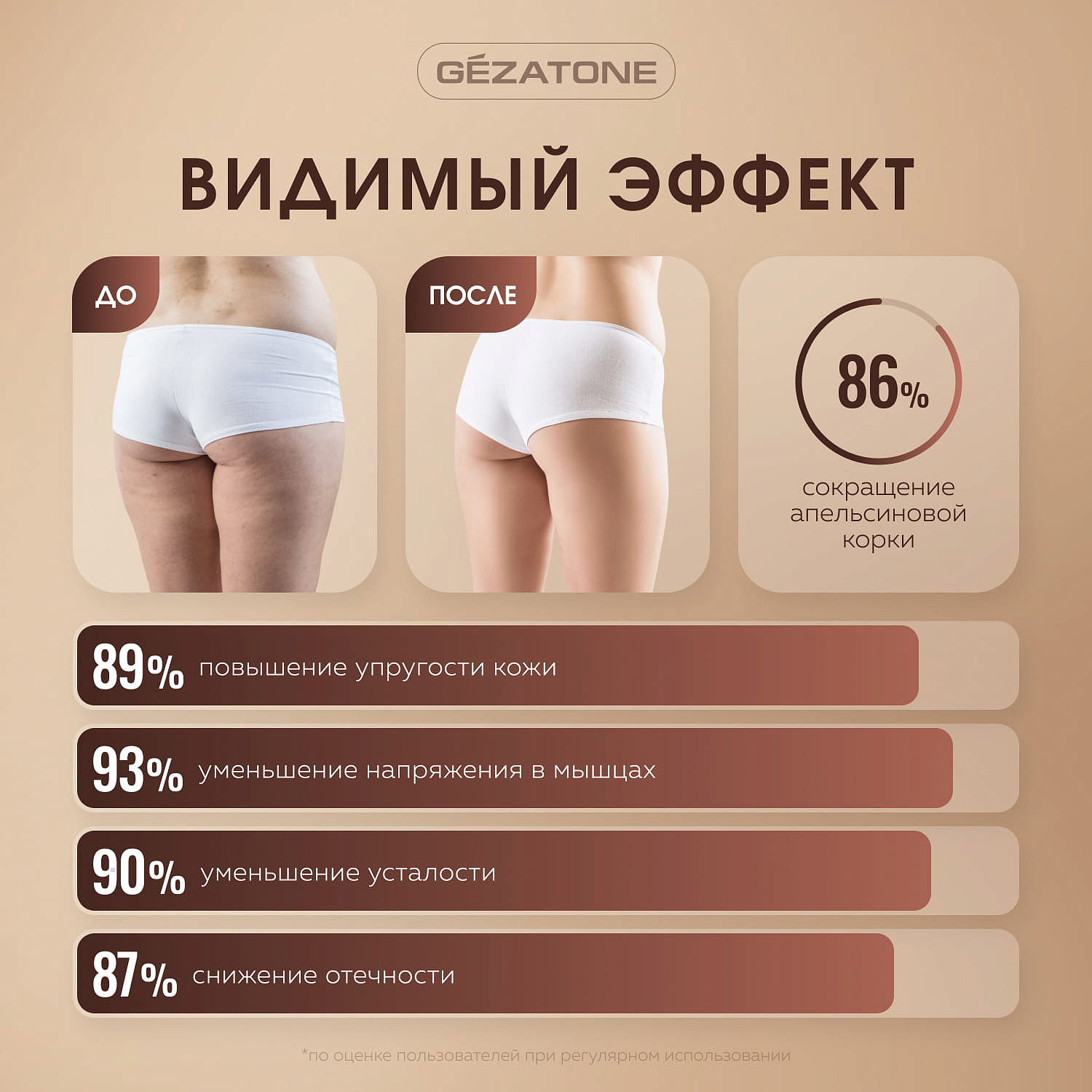 Антицеллюлитный вибромассажер для тела Body Shaper Neo AMG125SE, Gezatone 12