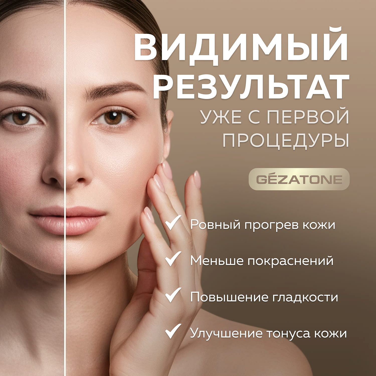 Гель для RF-лифтинга и лазерных процедур с успокаивающим фитокомплексом, Gezatone, 120 мл 10